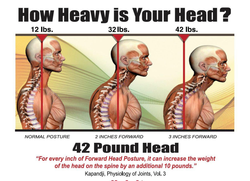 what-is-forward-head-posture-and-how-is-it-effecting-my-health